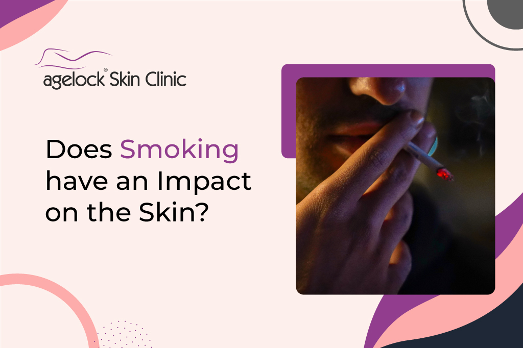 <strong>Does smoking have an impact on the skin?</strong>
