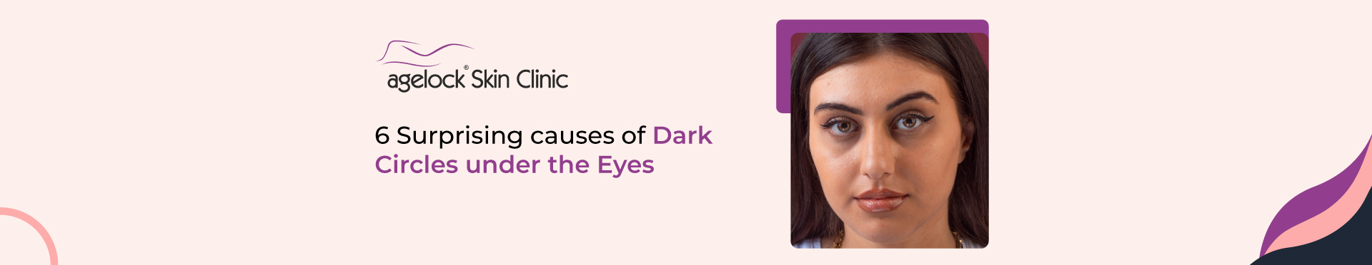 <strong>6 surprising causes of dark circles under the eyes</strong>