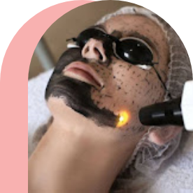 Cosmetic Laser Treatment