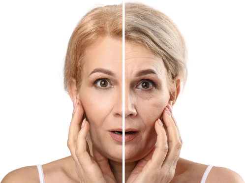 Vivace Anti Aging Treatment in Chandigarh