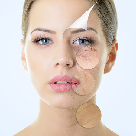 Hyaluronic Acid Therapy