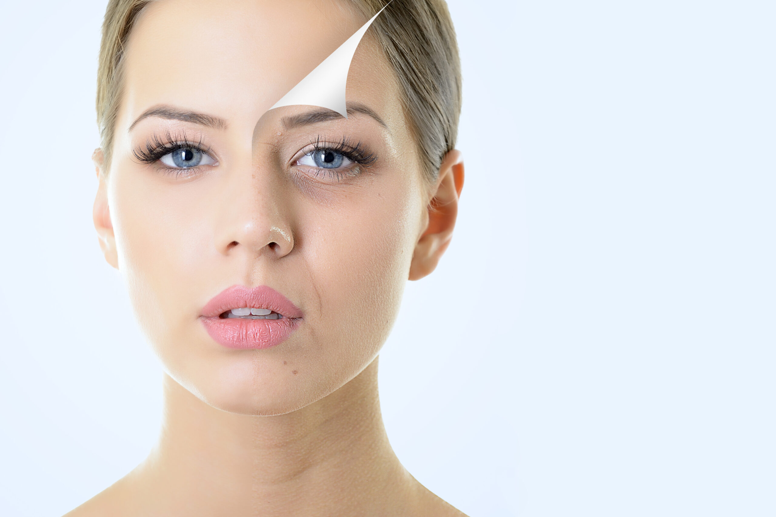 Photo Facial in Chandigarh