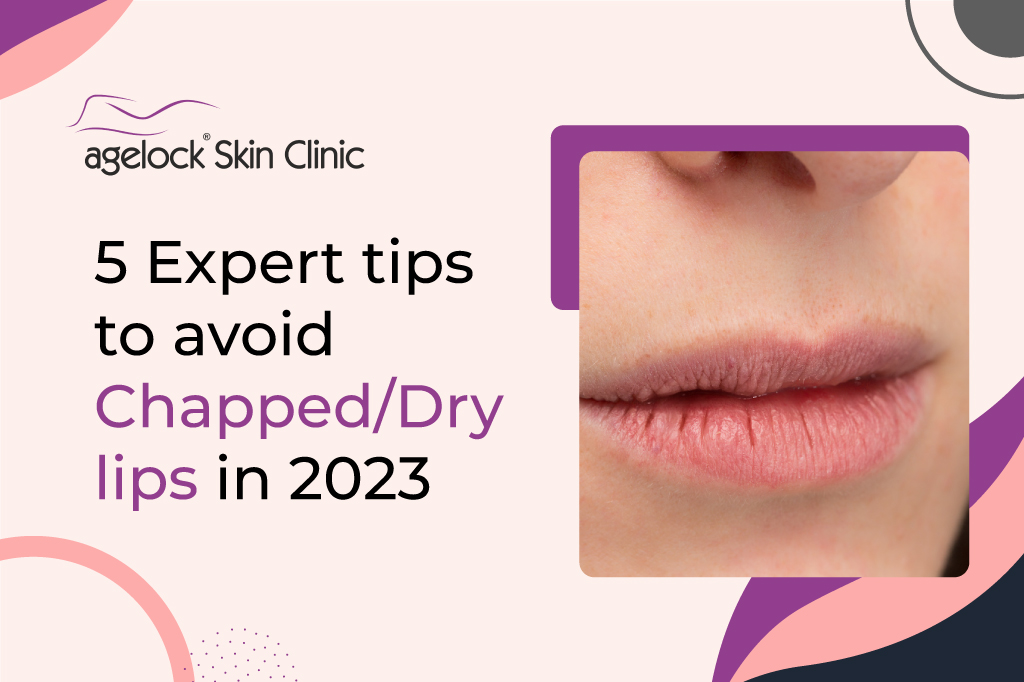 <strong>5 Expert tips to avoid chapped/dry lips in 2023</strong>