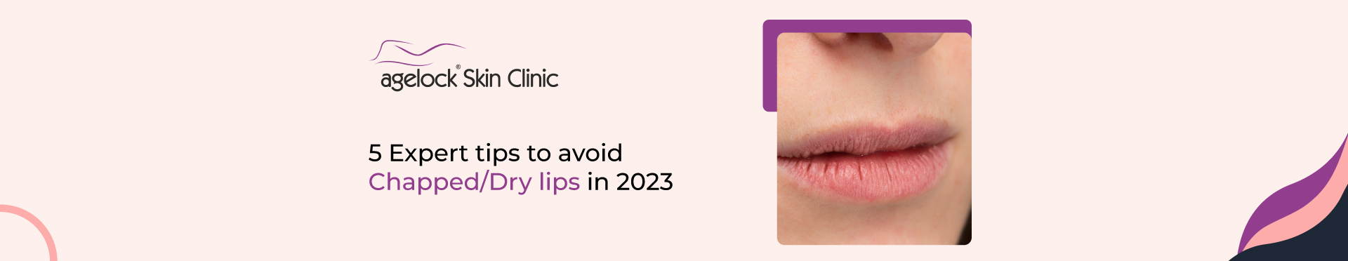 <strong>5 Expert tips to avoid chapped/dry lips in 2023</strong>