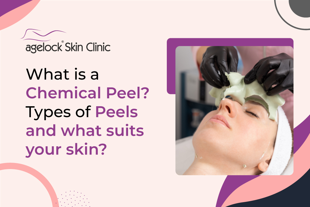 What is a Chemical Peel? Types of Peels and what suits your skin?