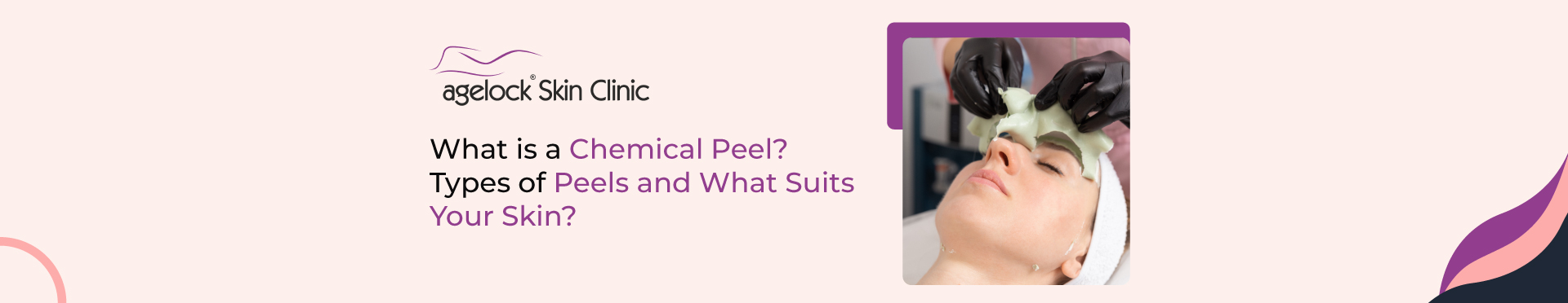 <strong>What is a Chemical Peel? Types of Peels and what suits your skin?</strong>