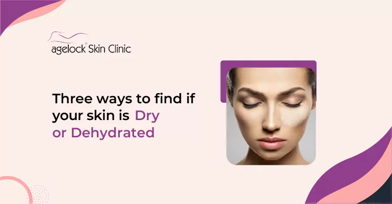 Three ways to find if your skin is dry or dehydrated