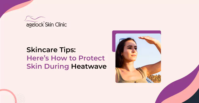 Skincare Tips: Here’s How to Protect Skin During Heatwave